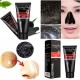 LuckyFine removedor de la espinilla de limpieza profunda adhesiva de la purificación del acné Negro Barro Mascarilla