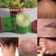 ECZEMA CURE TINEA CRURIS DERMATITIS PSORIASIS (7.5 G 3 FRASCOS)