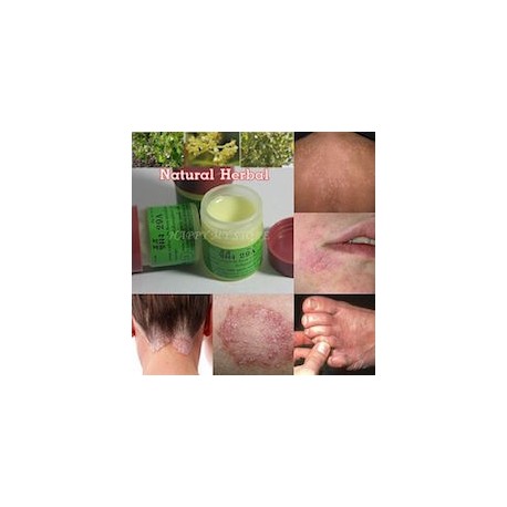 ECZEMA CURE TINEA CRURIS DERMATITIS PSORIASIS (7.5 G 3 FRASCOS)
