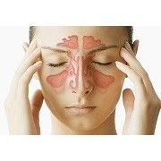 SINUSITIS